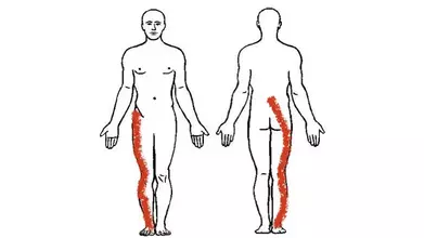 Body map with pain location indicated by a red pen stroke along the right leg
