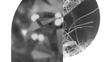 A letter "P" formed of images of neurons and filaments in black and white.